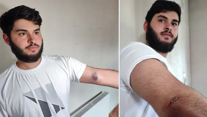 Bahçeden Kaçan Top, Mahallede Büyük Krize Neden Olmuştu